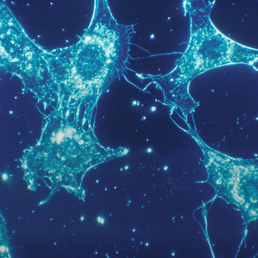 human connective tisse at 500x magnification